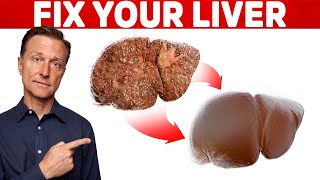 The 6 Best Ways to Heal a Fatty Liver [upl. by Thevenot]