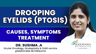 Drooping Eyelids Ptosis Know its Causes Symptoms and Treatment Kannada [upl. by Nameerf2]