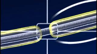 A SaltatoryConduction [upl. by Iridissa]