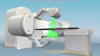 Prostate Cancer Treatment  IGRT Explained  At Spokane Cyberknife [upl. by Noisla]