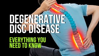 Degenerative Disc Disease  Everything You Need to Know [upl. by Naji]