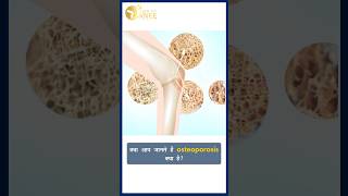 Osteoporosis क्या हैTreatment Symptoms amp Causes  CureMyKnee  osteoporosis shorts viral [upl. by Bechler]