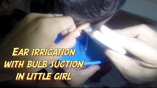 Ear Irrigation using Bulb Suction in little Girl [upl. by Buchbinder]