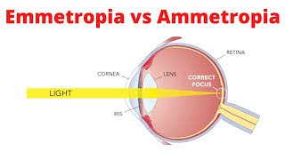 Emmetropia vs Ammetropia [upl. by Aihsein]