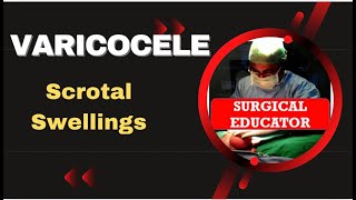 VARICOCELE How To DIAGNOSE amp TREAT Scrotal Swellings [upl. by Parcel373]