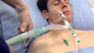 Using Intersurgicals TrachSeal™ closed suction systems [upl. by Mose]