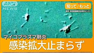 マイコプラズマ肺炎の患者急増 検査キット不足に懸念 100回分が1週間でなくなる【グッド！モーニング】2024年10月12日 [upl. by Enilamme]