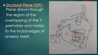 Cephalometric Planes [upl. by Vanni816]