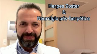 NEURALGIA PÓSHERPÉTICA E HERPES ZOSTER [upl. by Omrellig]