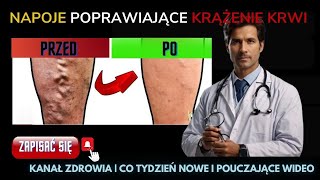 5 najlepszych napojów poprawiających krążenie krwizdrowie porady na temat zdrowia [upl. by Tansey701]