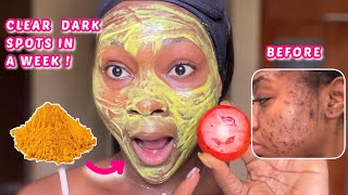 YOU WILL NEVER HAVE DARK SPOTS AGAIN  Get clear skin in a week using tomatoes amp turmeric skincare [upl. by Ahmar176]