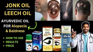 LEECH OIL  JONK OIL  FOR ALOPECIA  JONK KA TEL  HOW TO USE  REVIEW amp RESULTS  ESSENTIAL OIL [upl. by Euqinemod]