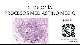 Citología de “Mediastino Medio” Parte I [upl. by Atinna]