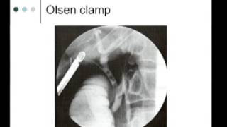 IntraOperative Imaging of the biliary system  Cholangiography [upl. by Wei]