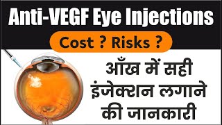 Eye injections for DIABETES ARMD RVO  Avastin Injection  Anti VEGF Injection  आँखों के इंजेक्शन [upl. by Deane]