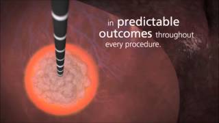 Covidien Emprint Ablation System with Thermosphere Technology [upl. by Ruelle]