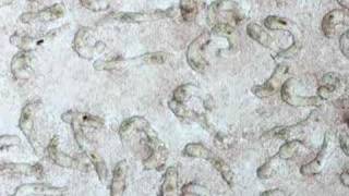 Schistosoma mansoni larvae cultured for 6 days [upl. by Eatnoled]