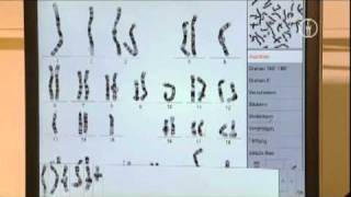 FWU  Chromosomen des Menschen  Erbkrankheiten und Karyogramme [upl. by Ezar555]