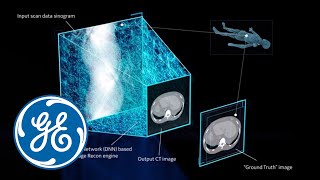 TrueFidelity Deep Learning Image Reconstruction  GE Healthcare [upl. by Aivin730]