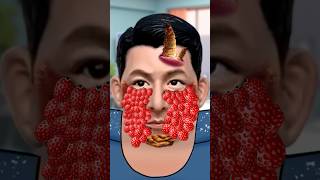 Andy Lau  ASMR remove ticks and giant maggots from Andy Lau 刘德华  severely injured treatment [upl. by Silohcin]