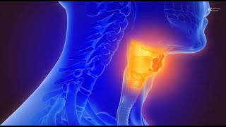 Mechanisms and prospects of HPVinduced oropharyngeal squamous cell carcinoma [upl. by Enawd]