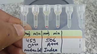 medicallabtechnologist6489 Blood Crossmatch Gel card method AgAbReaction MLT lab Blood [upl. by Eahcim]