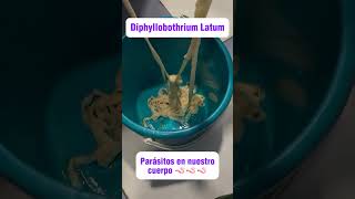 💡Diphyllobothrium Latum Parásitos 🪱 parasite cuerposaludable cuerpofit fish omg wtf [upl. by Adamec]