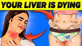 ⚠️ SILENT KILLER 8 Shocking Signs of Fatty Liver You Cant Ignore 🚫 Ultimate Liver Health Guide [upl. by Sokim]