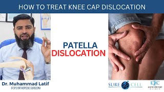 How to treat knee cap dislocation Patella Dislocation  Dr Latif [upl. by Ullman]