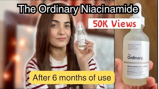 The Ordinary Niacinamide 10  zinc 1 Review WHAT ARE THE RESULTS after 6 months of USE [upl. by Feodor]