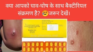 Bactrim d S Tablet use in hindi [upl. by Arratahs710]