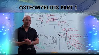 Osteomyelitis  Causes amp Symptoms  Bone Infection🩺 [upl. by Dombrowski]