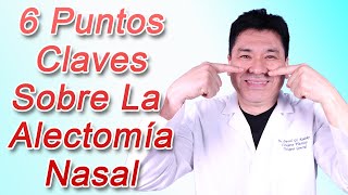 La Alectomía Nasal  6 Puntos Claves [upl. by Caren]