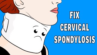 How to fix Cervical Spondylosis Neck Pain in 3 minutes [upl. by Heydon]