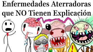 Enfermedades Más Aterradoras que la Ciencia NO Puede Explicar [upl. by Wanonah]