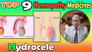 Hydrocele Causes Symptoms and homeopathy Treatment  Dr P S Tiwari [upl. by Oinesra305]