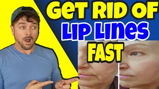 3 THINGS That Get Rid Of LIP LINES And WRINKLES  Chris Gibson [upl. by Billi]