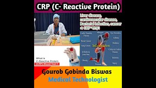 CRPC reactive Protein Test 4 Times Dilution in Bangla  serum amp Reagent  Inflammation [upl. by Innad]