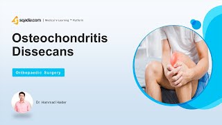 Osteochondritis Dissicens  Introduction  Orthopedic Surgery Lecture  VLearning™ [upl. by Nipha]