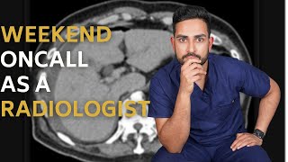 RADIOLOGIST ON CALL vlog 12 hours in the hospital [upl. by Benyamin656]