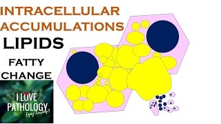 INTRACELLULAR ACCUMULATIONS LIPIDS Fatty Change [upl. by Cuyler980]