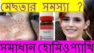 Mesta Dur Korar Upay  মেছতা দূর করার উপায়  Health Tips Bangla [upl. by Steady986]