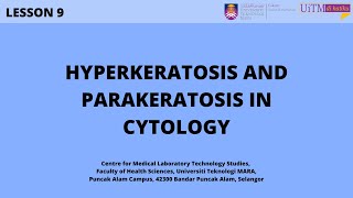 Hyperkeratosis and Parakeratosis in Cytology [upl. by Elwina]