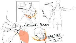 The Brachial Plexus II Animated Review HD [upl. by Nillor]