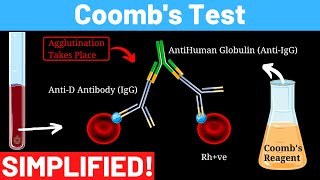 Indirect and direct Antiglobulin test Coombs test  direct and indirect  Panmedicad [upl. by Tamma]