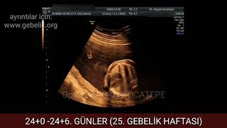 25 GEBELİK HAFTASINDA KIZ BEBEK NASIL GÖRÜNÜR AÇIKLAMALI RENKLİ DOPPLER 4D ULTRASON GÖRÜNTÜLERİ [upl. by Erreip]