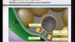 Spasticity Management [upl. by Eileme663]