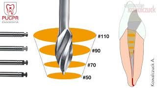 Técnica de Preparo Manual do Canal Radicular  Endodontia PUCPR [upl. by Coveney]