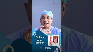 How Is Colon Cancer Treated  Insights from Dr Nilesh chordiya SSO [upl. by Dreeda]