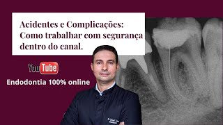 Acidentes e Complicações em Endodontia [upl. by Morten]